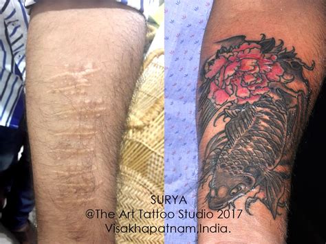Find Top Scar Cover Up Tattoo Artist near You Today!